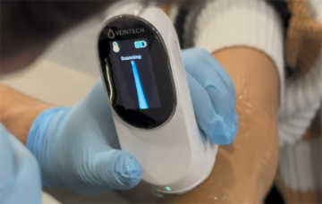 Close-up of a handheld VeinTech medical scanning device being used on a person's forearm, with a display screen showing an active scan in progress.